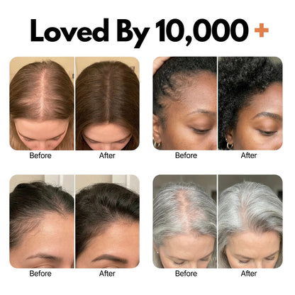 Veyla Hair Growth Serum