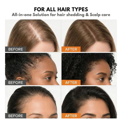 Veyla Hair Growth Serum