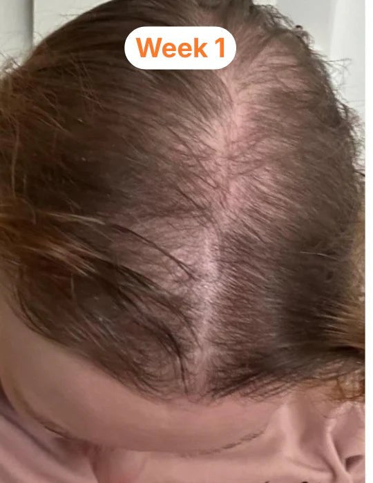 Thin, see-through front section at week 1