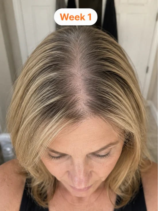 Blonde hair with a visible wide part at week 1